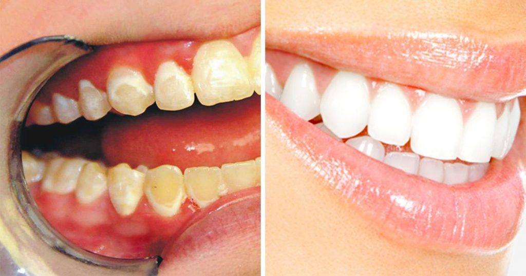 Entender por qué duelen los dientes